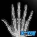 X Ray Scanner