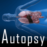 autopsy