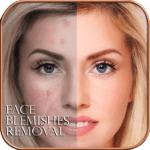 face blemishes removal