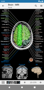 e-Anatomy 4.12.6 Apk for Android 3